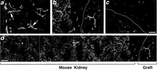 Fig. 6. Human blood vessels contribute to the vascularization of the thymic implant. Confocal microscopy of cryostat sections from the thymic graft of a CB/Thy-NOD/SCID mouse stained by 2-color immunofluorescence with an anti-human–specific CD34 MoAb (a, b, and d, red fluorescence) and an anti–PECAM-1 polyclonal Ab (a, b, and d, green fluorescence) or with isotype-matched control antibodies (c). Colocalization of the 2 markers (yellow) identifies numerous human vascular structures within the thymic parenchyma, as well as in the subcapsular region of the graft (a, arrows). Human vessels are also seen to penetrate the mouse kidney at the interface with the thymic graft (b, interface marked by dots). (d) Composite of 4 consecutive microscopic fields acquired from a section stained as above showing numerous human vessels infiltrating the mouse kidney at the interface with the thymic graft. Bar in a, b, and c = 42 μm; bar in d = 32 μm.