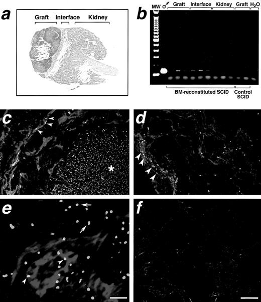 Fig. 7. Detection of CB-derived endothelial cells at the site of thymic implant. (a) Cryostat section from a human female thymic transplant engrafted into a NOD/SCID mouse reconstituted with male CB, stained by hematoxylin/eosin showing the sites of tissue sampling used for DNA preparation. PCR of these DNA samples for human male Y chromosome–specific sequences (b) shows the presence of Y chromosome in tissue within the graft, as well as in the mouse kidney, at the interface with the graft, but not in the mouse kidney distant from the thymic transplant. The DNA products amplified from triplicate samples of the indicated anatomical regions obtained from 3 consecutive sections are shown. The product from a positive control PCR using male CB cells (♂) is also shown on the left. The far left lane represents a 100-bp DNA ladder. The lane on the far right shows a control PCR using Y chromosome–specific primers and no template DNA. (c through f) Confocal microscopy of female thymic grafts from CB/Thy-NOD/SCID mice reconstituted with male CB stained by 2-color FISH using human Y chromosome–specific probes (green fluorescence) and a human specific anti-CD34 MoAb (c and d, red fluorescence) or an anti–PECAM-1 polyclonal antibody (e, red fluorescence). (f) Background fluorescence obtained using the FITC-conjugated antidigoxigenin antibody and isotype-matched control antibodies for the red fluorescence. CD34+ cells bearing the male Y chromosome are detected at the interface of the grafts with the mouse kidney (c, arrowheads), and in the pericapsular connective tissue (d, arrowheads). The star in (c) indicates the thymic graft. Y chromosome–bearing cells comprised within vascular structures, unequivocally identified by the PECAM-1 staining (e, red fluorescence, arrowheads), as well as other nonendothelial stromal elements (e, arrows) are also observed at the interface of the grafts with the mouse kidney. Bar in c, d, and f, 63.5 μm; bar in e, 31 μm.