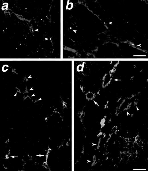 Fig. 8. Detection of CB-derived blood vessels at the site of thymic implant in SCID CB/Thy chimeras mismatched for sex or HLA-A2. (a and b) Confocal microscopy of a thymic graft from a CB/Thy SCID chimera transplanted with CB and thymus mismatched by sex. Human blood vessels, here identified by the expression of vWF (red), are shown to comprise Y chromosome-positive cells of CB origin, as detected by FISH (green, arrowheads). (c and d) Confocal microscopy of a thymic graft from a CB/Thy SCID chimera transplanted with CB and thymus mismatched for the expression of HLA-A2. The transplanted thymic tissue was from an HLA-A2+ donor, whereas CB cells were from an HLA-A2− donor. Human blood vessels of thymic origin (arrows) are identified by the coexpression of vWF (red) and HLA-A2 (green). In addition, a number of human vWF+ blood vessels lacking expression of HLA-A2 are observed (arrowheads), indicating the participation of CB cells to the revascularization of the graft. Bar in b = 42.3 μm; bar in a, c, and d = 63.5 μm.