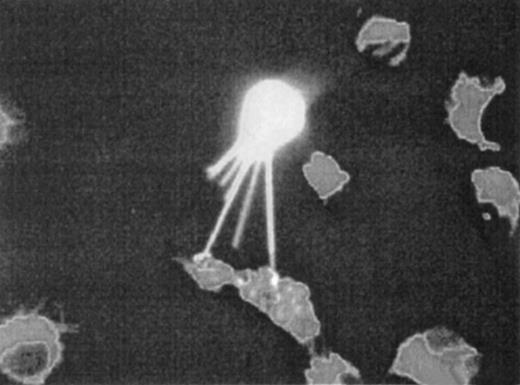 Fig. 1-1. CD34+ KG1a cell with tenupodia that contact fibroblastic HT1080 cells.