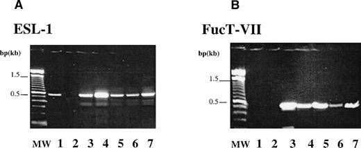Fig. 1. Expression of ESL-1 and FucT-VII by CD34+cells. RT-PCR analysis was performed to examine the capacity of CD34+ cells to express ESL-1 and FucT-VII. (A) The expected product of 450 bp for ESL-1 could be detected in BMEC (lane 1, EC), HL60 (lane 3, positive control), PB CD34 cells (lane 4, PB), BM CD34 cells (lane 5, BM), FL CD34 cells (lane 6, FL), and CB CD34 cells (lane 7, CB). RT (lane 2) is the PCR reaction without addition of RT. (B) The expected product of 497 bp for FucT-VII could be detected in HL60 (lane 3, positive control) and in PB- (lane 4), BM- (lane 5), FL- (lane 6), CB-derived CD34(+) cells (lane 7). FucT-VII expression is only limited to hematopoietic cells, and BMEC (EC, lane 1) did not express FucT-VII. RT control (lane 2) is the PCR reaction without addition of RT.