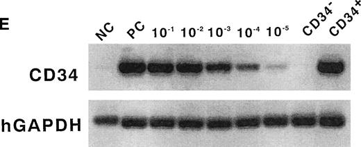 Fig. 1. A flow cytometric analysis of lineage-specific antigens and CD34 expression on human cord blood cells and their purification. Staining profile of lineage markers and CD34 versus CD45 expression on human cord blood MNCs before (A) and after filtration (B). (C) Sorted Lin−CD34− cells show a more than 99% pure fraction. (D) Isotype antibody was used as a negative control. (E) Semiquantitative RT-PCR analysis from CD34−Lin− cells. Top lane, human CD34 cDNA amplification; bottom lane, GAPDH cDNA amplification used to normalize RT-RNAs; PC, RT-PCR products from KG-1 cells; NC, water; CD34−, sorted CD34− cells; CD34+, sorted CD34+ cells; 10−1, 10−2, 10−3, 10−4, and 10−5, ratio of positive and negative cell; 10−5, mean positive and negative cell ratio is 1:105.