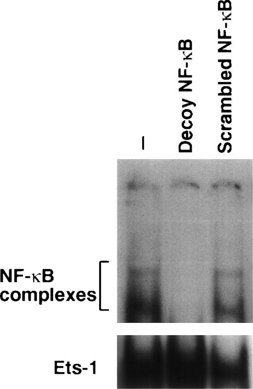 Fig. 2. Downmodulation of NF-κB/Rel nuclear complexes by a κB decoy oligodeoxynucleotide in 32D cells. 32D cells (2 × 105/mL) were incubated in the presence or absence of 7.5 μmol/L κB decoy (5′-CCTTGAAGGGATTTCCCTCC-3′) or scrambled (5′-CCTTGTACCATTGTTAGCC-3′) oligodeoxynucleotide for 16 hours. Nuclear extracts were then obtained, incubated with a32P-labeled κB oligonucleotide, and analyzed by EMSA.