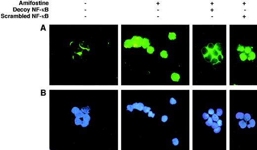 Fig. 5. Effect of the κB decoy oligonucleotide on the NF-κB/Rel nuclear complexes in CD34+ cells. CD34+ cells (purity, >96%, ≤99%; 7.5 × 105/mL) were incubated in 10% FCS-RPMI, with or without amifostine (8 μg/mL), decoy, or scrambled oligo (5 μmol/L) for 16 hours. The cells were then analyzed in immunofluorescence with an antihuman NF-κB/p65 rabbit polyclonal serum and FITC-conjugated goat antirabbit Ig antibodies.