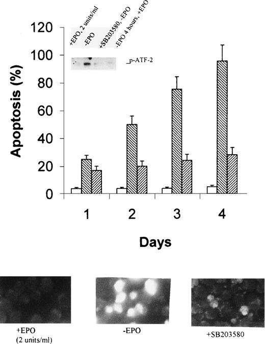 Fig. 7. SB203580 inhibits p38 MAPK activity and retards apoptosis of HCD-57 cells in the absence of EPO. Cells were pretreated with 10 μmol/L SB203580 for 4 hours in normal growth medium before starvation with EPO-free medium supplemented with the same concentration of the inhibitor. The inset in the top panel shows p38 MAP kinase activity after 2 days of EPO starvation, as determined by using ATF-2 as a substrate. Apoptosis was determined by flow cytometric assays after 1 to 4 days of EPO withdrawal (top panel) and by fluorescent cell staining after 2 days (bottom panel). The photograph was taken with 400× magnification. The stock solution of SB203580 was made in water. Open bars and bottom, left photo, EPO-containing medium; reverse-slashed bars and the bottom, middle photo, EPO-free medium; and slashed bars and the bottom, right photo, EPO- free medium plus 10 μmol/L SB203580.