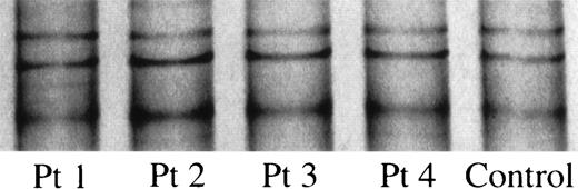 Fig. 2. PCR-SSCP analysis of the G-CSFR cytosolic domain. The PCR was performed with primers FW4 and RV6 as described in Materials and Methods. The RT-PCR products from 4 patients (Patients 1 to 4) and normal controls (control) underwent polyacrilamide gel electrophoresis for 3 hours, and the bands were visualized by the silver-staining method.