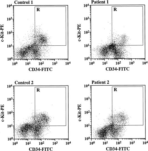 Fig. 3. Flow cytometric analysis of CD34 and c-Kit expression on bone marrow cells from normal subjects and the patients with SCN. Nonadherent LDBMC enriched for CD34-FITC (see Materials and Methods) were stained by Kit-PE. R indicates the gate for CD34+/Kit+ cells. The figure shows a representative flow cytometric analysis for 2 patients with SCN and 2 normal subjects.