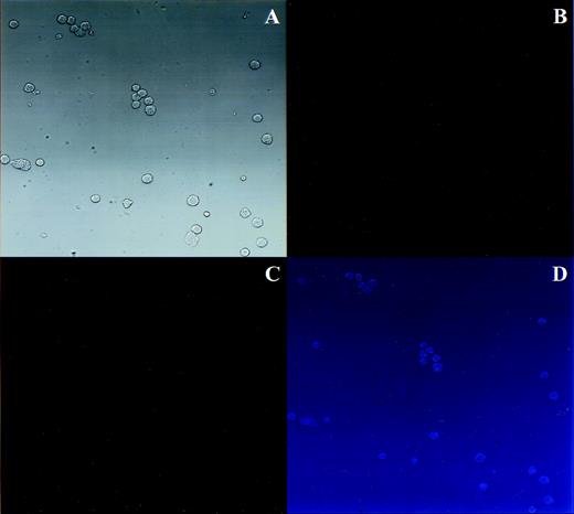 Fig. 5. Transduced MKs retain typical MK morphology and phenotype. PEG-rHuMGDF–cultured cells that were incubated with AdCNLacZ or control were harvested for simultaneous analysis of β-gal expression and GPIIb-IIIa activation. Cells were incubated with PE-GPIb antibody (or PE-IgG control) and FITC-PAC1 in the presence or absence of TRAP before fixation and in situ X-gal staining. In each set of 4 photomicrographs, the first panel shows images using light transmission microscopy, the second and third show the same field using fluorescence microscopy, and the fourth shows a computer generated overlay of the first 3 images. (A through D) Virus control, PE-IgG control, FITC-PAC1, unstimulated for light transmission, PE fluorescence, FITC fluorescence, and overlay, respectively. (E through H) AdCNLacZ, PE-GPIb, FITC-PAC1, TRAP for light transmission, PE fluorescence, FITC fluorescence, and overlay, respectively. Note that in these black and white light transmission images X-gal–stained nuclei appear as black instead of blue. The arrow indicates a successfully transduced morphologic and phenotypic MK. All photomicrographs are 400×.