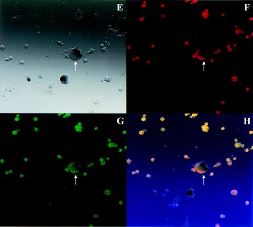 Fig. 5. Transduced MKs retain typical MK morphology and phenotype. PEG-rHuMGDF–cultured cells that were incubated with AdCNLacZ or control were harvested for simultaneous analysis of β-gal expression and GPIIb-IIIa activation. Cells were incubated with PE-GPIb antibody (or PE-IgG control) and FITC-PAC1 in the presence or absence of TRAP before fixation and in situ X-gal staining. In each set of 4 photomicrographs, the first panel shows images using light transmission microscopy, the second and third show the same field using fluorescence microscopy, and the fourth shows a computer generated overlay of the first 3 images. (A through D) Virus control, PE-IgG control, FITC-PAC1, unstimulated for light transmission, PE fluorescence, FITC fluorescence, and overlay, respectively. (E through H) AdCNLacZ, PE-GPIb, FITC-PAC1, TRAP for light transmission, PE fluorescence, FITC fluorescence, and overlay, respectively. Note that in these black and white light transmission images X-gal–stained nuclei appear as black instead of blue. The arrow indicates a successfully transduced morphologic and phenotypic MK. All photomicrographs are 400×.