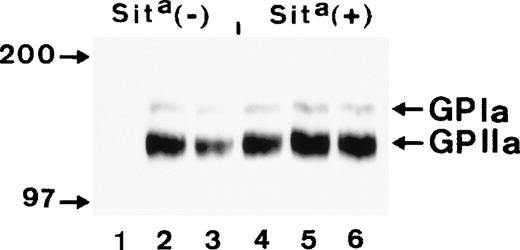 Fig. 3. Immunoprecipitation analysis of biotin surface-labeled platelets derived from a Sita (−) and a Sita(+) individual with anti-Sita (lanes 1 and 4), anti-Bra (lanes 2 and 5), and anti-Brb (lanes 3 and 6). Immunoprecipitates were separated on 7.5% sodium dodecyl sulfate-polyacrylamide gel electrophoresis (SDS-PAGE) under nonreduced conditions, transferred onto nitrocellulose membrane, and visualized using streptavidin-horseradish peroxidase and chemiluminescent substrate.