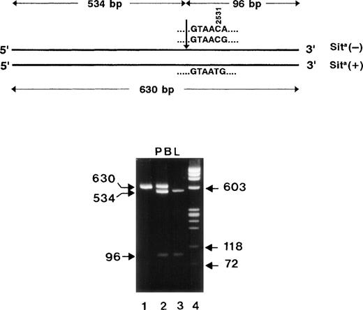 Fig. 6. Restriction map of the 630-bp PCR products (top). The arrow indicates the position of the restriction site for MaeIII endonuclease. The length of the restriction fragments is shown above. RFLP analysis of PCR-amplified genomic DNA derived from peripheral blood cells (PBL) of Sita-phenotyped individuals. DNA fragments were analyzed on 1.6% agarose gel stained with ethidium bromide (bottom). The undigested 630-bp PCR product is shown in lane 1. Lanes 2 and 3 represent the analysis of MaeIII-digested PCR product derived from DNA of a Sita (+) heterozygous individual and a Sita (−) individual, respectively. Lane 4, DNA size standards (pBR328 DNA.BglI + pBR328 DNA.HinfI).