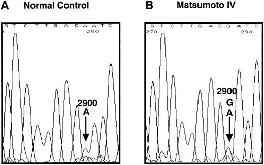 Fig. 1. Nucleotide sequence of the fibrinogen γ-chain gene exon VI. The PCR-amplified γ-chain genes of the normal control (A) and the propositus (B) were directly sequenced by dideoxy termination method using the reverse primer. The nucleotide position 2900, indicated by the arrow in (B), of the propositus' gene was heterozygous for A and G. This nucleotide substitution changed the γ153Cys→Arg as shown in (C). The underlined nucleotide is located in the intron region.