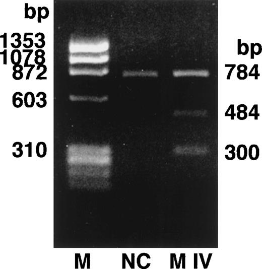 Fig. 2. Endonuclease restriction digestion of fibrinogen γ-chain gene exon VI. The PCR-amplified γ-chain genes of the normal control (NC) and the propositus (M IV) were digested by Mbo I. The normal control showed 1 band of 784 bp and the heterozygous propositus showed 3 bands of 784, 484, and 300 bp.