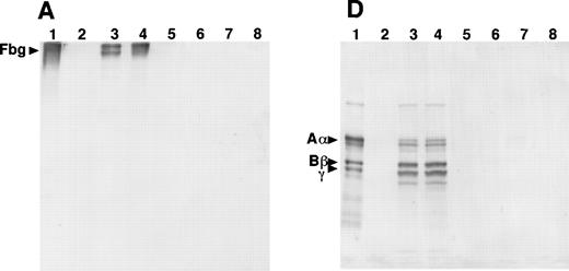 Fig. 3. Western blot analysis of fibrinogen in media (A and D) or in CHO cell lysates (B, C, E, and F) that were transfected with mutant or normal fibrinogen γ-chain plasmid. The samples were subjected to 8% SDS-PAGE under nonreduced conditions (A, B, and C) or 10% SDS-PAGE under reduced conditions (D, E, and F). After transfer to nitrocellulose membrane, blots were developed with a rabbit antihuman fibrinogen antibody (A, B, D, and E) or a rabbit antihuman fibrinogen γ-chain antibody (C and F) that reacted to not only human fibrinogen γ-chain, but also to Bβ-chain. The samples in each figure were (1) purified fibrinogen from normal control plasma, (2) ABβ CHO cells, (3) γ153C-7, (4) γ153C-16, (5) γ153R-24, (6) γ153R-32, (7) γ153A-7, and (8) γ153A-11.