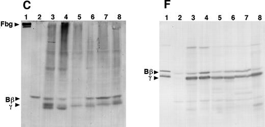 Fig. 3. Western blot analysis of fibrinogen in media (A and D) or in CHO cell lysates (B, C, E, and F) that were transfected with mutant or normal fibrinogen γ-chain plasmid. The samples were subjected to 8% SDS-PAGE under nonreduced conditions (A, B, and C) or 10% SDS-PAGE under reduced conditions (D, E, and F). After transfer to nitrocellulose membrane, blots were developed with a rabbit antihuman fibrinogen antibody (A, B, D, and E) or a rabbit antihuman fibrinogen γ-chain antibody (C and F) that reacted to not only human fibrinogen γ-chain, but also to Bβ-chain. The samples in each figure were (1) purified fibrinogen from normal control plasma, (2) ABβ CHO cells, (3) γ153C-7, (4) γ153C-16, (5) γ153R-24, (6) γ153R-32, (7) γ153A-7, and (8) γ153A-11.