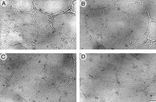 Fig. 5. HUVEC morphogenesis on Matrigel. Cells (2 × 105) were plated per 1.25 cm2 well precoated with Matrigel and grown for 6 hours (A) in the specific medium alone (positive control) or containing (B) VBL 0.5 pmol/L, (C) 1 pmol/L, or (D) in the medium without FCS (negative control). Sub (A), cells arranged in branching, reciprocally anastomosing tubes forming a closely knit capillary-like plexus; sub (B) and (C), progressive alterations of the plexus parallel with increasing VBL dose. Bar = 30 μm from (A) to (D).