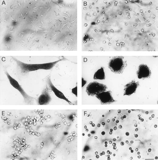 Fig. 8. Cytotoxicity of VBL. Cells were exposed to VBL in the specific growth medium as described in the proliferation assay (Fig1A): pictures on day 4. (A) HUVEC exposed to 1 pmol/L and (B) 2 pmol/L: note detached cells with loss of elongated shape and cytoplasmic swelling. (C) EA.hy926 cells exposed to 1 pmol/L and (D) 2 pmol/L, fixed in 2.5% glutharaldehyde and stained with May-Grünwald-Giemsa: note signs of toxicity as in HUVEC. (E) Human lymphoblastic leukemia T-cells (CEM cells) exposed to 2 pmol/L and (F) 40 pmol/L: different from (E), note many cells with dusty cytoplasm and some cells with nuclear pyknosis. Bar = 30 μm in (A), (B), (E), (F); 16 μm in (C), (D).