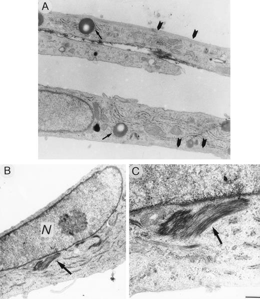Fig. 9. Ultrastructural sections of HUVEC under standard culture conditions (A) and after exposure to 0.1 pmol/L VBL (B, C). Cells appear elongated with cytoplasm containing organelles, lipid droplets (arrow) and subcortical microfilaments extending across the cells (arrowheads). (B, C) A bundle of microfilaments (arrow) accumulated to nucleus (N) of a spindle-shaped endothelial cell. Bar (A), (B) = 16.6 μm; (C) = 0.5 μm.