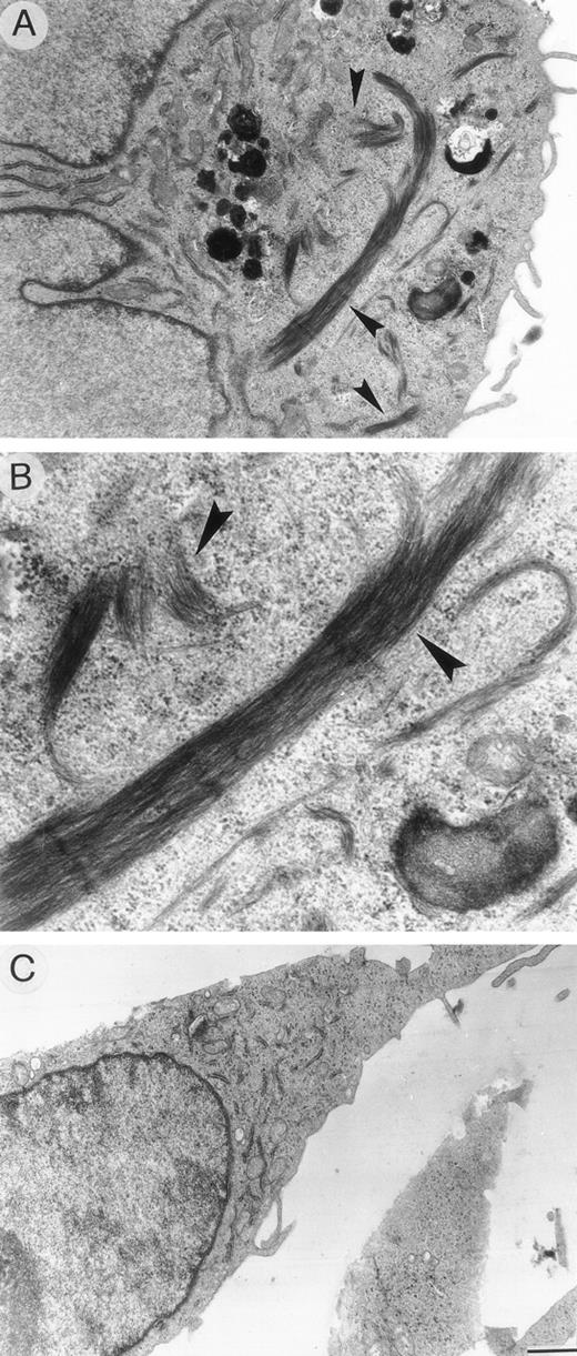 Fig. 10. Ultrathin sections of HUVEC cells exposed to (A, B) 1 pmol/L VBL and (C) 24 hours after removing the VBL-containing medium. (A, B) Round-shaped endothelial cell displaying numerous bundles of thickened microfilaments distributed in the cytoplasm (arrow). (C) Endothelial cell showing normal distribution of cytoskeleton organelles. Bar (A), (C) = 16.6 μm; (B) = 0.5 μm.