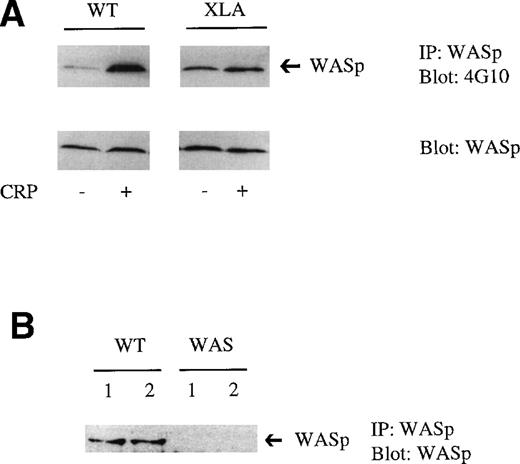 Fig. 3. Tyrosine phosphorylation of WASp in XLA platelets stimulated with CRP. (A) WASp was immunoprecipitated from resting or CRP (3 μg/mL)-stimulated platelets. Proteins were resolved on 10% SDS-PAGE, transferred, and immunoblotted using the antiphosphotyrosine MoAb 4G10 (upper panel). Reprobing with the anti-WASp MoAb confirmed that a similar level of WASp was present in control and XLA platelets (bottom panel). One experiment is shown that is representative of 3. (B) WASp was immunoprecipitated from resting platelets from control (WT) and WAS patients. Proteins were resolved on 10% SDS-PAGE, transferred, and immunoblotted using the WASp MoAb.