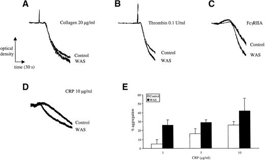 Fig. 4. Aggregation in WAS platelets. Platelets from control and WAS patients were prepared as described in Materials and Methods. Care was taken to ensure that platelets were prepared in exactly the same way and used at the same concentration. The experiments in (A) through (C) were performed on the same day in the absence of indomethacin at a platelet concentration of 2 × 108/mL. Collagen is unable to stimulate aggregation in the presence of indomethacin; similar results were observed for thrombin in the presence of indomethacin. The experiments in (D) and (E) were performed on a separate donor in the presence of indomethacin and at a lower platelet concentration of 0.7 × 108/mL. The mean aggregation over the length of the concentration response curve to collagen was measured. The results are representative of between 2 and 5 separate experiments.
