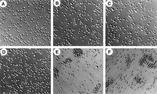 Fig. 2. CHO-GPIbβ/IX cell aggregation. CHO-GPIbβ/IX cells (106 cells/mL) were exposed to rotary shaking at 6 cycles per second for 20 minutes either in the absence of vWF (A, C, and D) or in the presence of vWF (B, E, and F) to which either buffer (A and B), ristocetin (C and E), or heparin (D and F) was added. Microphotographs of cell aggregation were taken at a 10-fold magnification. vWF-dependent cell aggregation was seen in the presence of ristocetin or heparin.