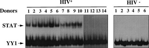 Fig. 1. Constitutive activation of STAT in HIV+patients. EMSA using WCEs (8 μg), obtained from PBMCs isolated from 6 healthy HIV− and 14 HIV+ individuals, and a mixture of PRE and UCR radiolabeled oligonucleotides. Constitutive YY1-DNA binding serves as a control.
