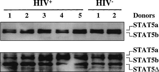 Fig. 3. STAT5 expression in HIV-infected patients. Immunoblotting of WCEs (10 μg) of PBMCs isolated from 4 HIV-infected and 2 healthy, HIV− individuals using a mixture of anti-STAT5a and anti-STAT5b rabbit polyclonal Abs in the upper panel and, after stripping of the filter, using an anti-STAT5 mouse MoAb that recognizes an internal epitope of STAT5 (lower panel).