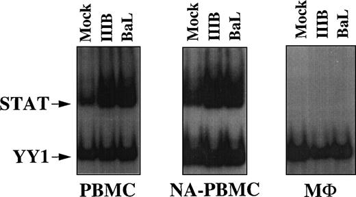Fig. 6. STAT activation in resting PBMCs exposed in vitro to HIV-1. EMSA using WCEs (8 μg) obtained from resting PBMCs, NA-PBMCs, and M▹ exposed for 7 days to HIV-1IIIB/LAI and HIV-1BaL strains (0.1 moi) and a mixture of PRE and UCR radiolabeled oligonucleotides. After a single round of purification, CD4+-depleted PBMCs of patients no. 15 and 16 contained 3% and 1% CD4+ cells, respectively, whereas CD8+-depleted PBMCs contained 0.3% and 1% CD8+ cells, respectively.