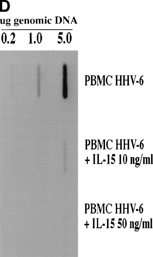 Fig. 1. Effect of IL-15 on infection of PBMC by HHV-6. PBMC were PHA-activated, infected with HHV-6 for 2 hours, and cultured in the absence (A) or presence of 10 ng/mL (B) or 50 ng/mL (C) recombinant IL-15 (rIL-15). On day 7 postinfection, cells were harvested and tested for cell surface expression of HHV-6 antigen by flow cytometry. Results are presented as overlay histograms, with the black histograms representing cells stained with anti–HHV-6 MoAb, whereas the white histograms represent cells stained with an irrelevant MoAb. (D) depicts the results obtained when HHV-6–infected cells, treated or not with IL-15, were analyzed for HHV-6 DNA content. Genomic DNA was hybridized with the 32P-labeled HHV-6 pZVH14 probe.