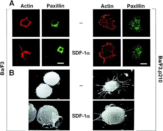 Fig. 2. (A) Actin and paxillin staining, as visualized by confocal microscopy, of untransformed and BCR/ABL-transformed hematopoietic cells in response to SDF-1. Cells were fixed and stained for actin using rhodamine-labeled phalloidin, and for paxillin using indirect immunofluorescent staining with the antipaxillin monoclonal antibody 5H11. Note the difference in shape and staining pattern of actin and paxillin in response to SDF-1 of normal Ba/F3 cells. There is no change in shape or staining pattern in response to SDF-1 for BCR/ABL-transformed Ba/F3 cells. The bar is 10 μm. (B) Scanning electron microscopy of untransformed and BCR/ABL-transformed hematopoietic cells in response to SDF-1. Ba/F3 cells and BCR/ABL-transformed Ba/F3 cells were either unstimulated or stimulated with SDF-1 and scanning electron micrographs were taken. Shown is the ruffling of an untransformed Ba/F3 cell; BCR/ABL containing cells had numerous extensions but there was no change in response to SDF-1. The bar represents 1.0 U.