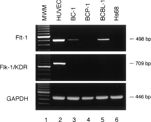 Fig. 3. Expression of VEGF/VPF receptors in PEL cells detected by RT-PCR. cDNAs from HUVECs, PEL cells (BC-1, BCP-1, and BCBL-1), and skin fibroblast (Hs68) cells were subjected to PCR amplification for Flt-1 and Flk-1/KDR (498- and 709-bp products, respectively). The quality of RNA was confirmed by parallel RT-PCR amplification for GAPDH. MWM, molecular weight marker.
