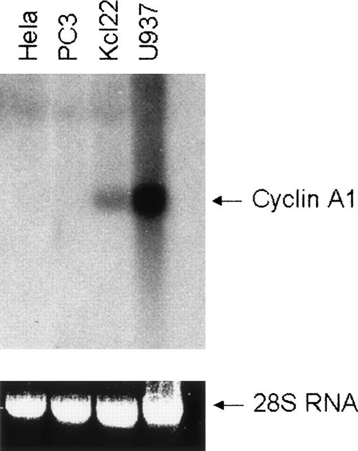 Fig. 1. Expression of cyclin A1 in different cell lines. Expression of human cyclin A1 mRNA in human tumor cell lines was analyzed by Northern blotting of 10 μg of total RNA and hybridization with a 32P-labeled cyclin A1-specific probe. The levels of 28S RNA show that equal amounts of RNA were loaded. HeLa (cervical carcinoma) and PC3 (prostate cancer) cell lines were derived from solid tumors, and U937 and Kcl22 were established from leukemic blasts.
