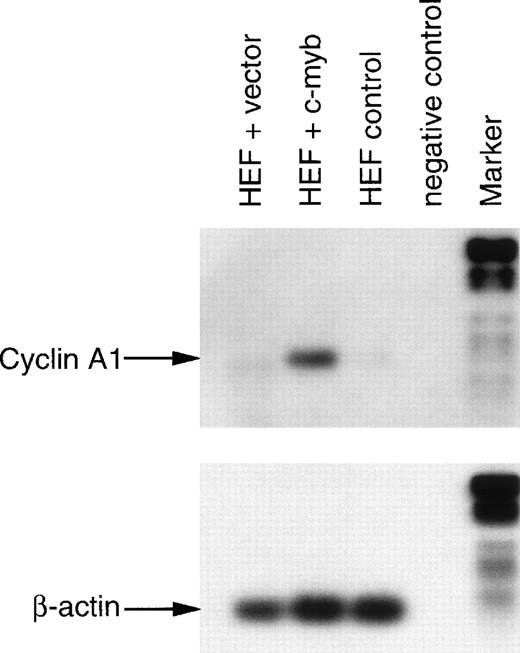 Fig. 8. c-myb induces endogenous cyclin A1 expression in human embryonic fibroblasts (HEF). Primary human embryonic fibroblasts were transfected, and after 48 hours, they were sorted by flow cytometry using EGFP expression as a marker of transfection (see Materials and Methods). HEF were transfected either with empty vector alone (HEF + vector) or with a c-myb expression vector (HEF + c-myb). Nontransfected cells of the latter transfection were also sorted and served as an additional control (HEF control). Finally, a sample with ddH2O instead of RNA for the reverse transcription reaction served as a negative control (negative control). After the PCR reactions for cyclin A1 (28 cycles, 382 bp) and β-actin (20 cycles, 210 bp), products were run on agarose gels, blotted, and hybridized with digoxigenin-labeled internal oligonucleotides. Detection was performed using antidigoxigenin antibody and a chemiluminescence reaction. The digoxigenin-labeled marker VI (Boehringer Mannheim) was run in parallel: 154, 220/234, 298, 394, 453, 517, 653, and 1,033 bp. The 154-bp band of the marker is too weak to be seen on the β-actin blot.