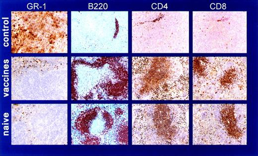 Fig. 4. Vaccinated leukemic mice have spleen features comparable with naive mice. Spleen immunohistochemistry of (A) control pac-AML–vaccinated leukemic mouse; (B) IL12-AML–vaccinated leukemic mouse; and (C) naive SJL mouse. The spleen from pac-AML–vaccinated mouse is almost completely infiltrated by Gr-1–positive cells and has very few residual B220 (B cells) and CD4/CD8 (T cells) positive cells. In contrast, the distribution of myeloid and lymphoid cells in the IL12-AML spleen is comparable with naive spleen.