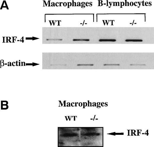 Fig. 3. IRF-4/Pip protein and mRNA are expressed in mouse primary macrophages. (A) IRF-4/Pip mRNA is expressed in mouse primary macrophages and B lymphocytes. The expression levels of the IRF-4/Pip gene was determined in primary macrophages and B lymphocytes from wild-type and ICSBP-deficient mice. The arrows show the band for IRF-4/Pip and for the β-actin control. (B) The IRF-4/Pip protein is present in mouse primary macrophages from wild-type and ICSBP-deficient mice. The presence of the IRF-4/Pip protein in mouse macrophages in wild-type and ICSBP−/− mice was determined by a Western blotting assay.