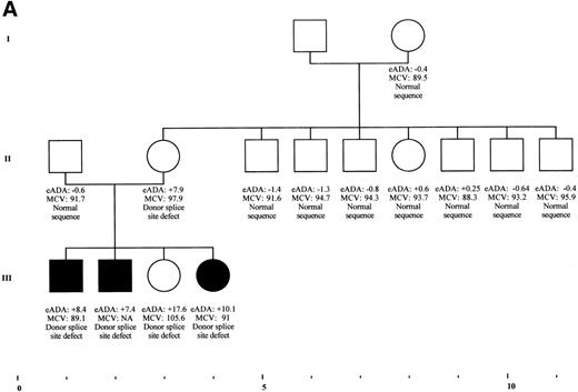 Fig. 5. Cosegregation of mutation in RPS19 gene in 2 families sharing both DBA phenotype and isolated high eADA phenotype. (A) Cosegregation of a donor splice site defect of exon 2 in individuals from family F66 with various clinical presentation: DBA phenotype (individuals III-1, III-2, III-3), silent phenotype restricted to an isolated elevation of eADA activity (individual II-2), and transient erythroblastopenia in individual III-3, with a persistent high eADA activity. The mutation was not found in any of the other family members explored. eADA values are expressed as SD from the mean. Fetal hemoglobin is expressed as a percentage. NA, not available. (B) Cosegregation of a 2-bp deletion in exon 5 in family E10. DBA proband III-4 is transfusion-independent under steroid therapy, whereas individuals II-2 and I-3 never received any treatment, although they were anemic during early childhood. eADA values are expressed as SD from the mean. NA, not available.