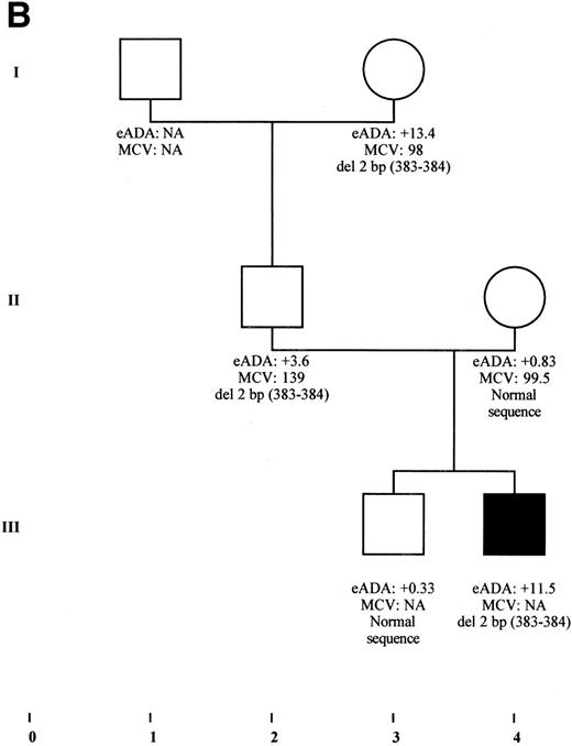 Fig. 5. Cosegregation of mutation in RPS19 gene in 2 families sharing both DBA phenotype and isolated high eADA phenotype. (A) Cosegregation of a donor splice site defect of exon 2 in individuals from family F66 with various clinical presentation: DBA phenotype (individuals III-1, III-2, III-3), silent phenotype restricted to an isolated elevation of eADA activity (individual II-2), and transient erythroblastopenia in individual III-3, with a persistent high eADA activity. The mutation was not found in any of the other family members explored. eADA values are expressed as SD from the mean. Fetal hemoglobin is expressed as a percentage. NA, not available. (B) Cosegregation of a 2-bp deletion in exon 5 in family E10. DBA proband III-4 is transfusion-independent under steroid therapy, whereas individuals II-2 and I-3 never received any treatment, although they were anemic during early childhood. eADA values are expressed as SD from the mean. NA, not available.