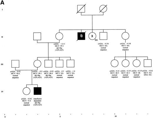 Fig. 6. (A) Transmission of a deletion in exon 1 of RPS19 gene in a family with DBA phenotype and isolated high eADA phenotype. The 4-bp deletion found in the first, noncoding exon of RPS19 gene in the DBA proband IV-3 from family F1 was also found in the mother (III-3) and the grandmother (II-5) who presented only with a high eADA phenotype. Other factors are probably involved in this family, because individual III-4 carries the same deletion, but with a strictly normal phenotype, whereas the deletion could not be found in individual II-11, despite an isolated high eADA phenotype. eADA values are expressed as SD from the mean. NA, not available. (B) Partial segregation of a mutation in a DBA family. The acceptor splice site defect of exon 4 was found in the DBA proband III-4, as well as in his father (II-3) presenting with macrocytic anemia. Erythrocyte ADA value measured in the healthy brother III-5 is between +2 and +3 SD, although he does not carry this mutation. eADA values are expressed as SD from the mean. NA, not available.