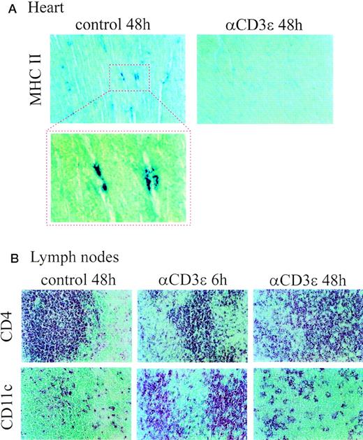 Fig. 3. Altered DC distribution in peripheral lymphoid and nonlymphoid organs after anti-CD3ɛ administration. Alkaline phosphatase staining of cryostat section of (A) hearts and (B) mesenteric lymph nodes (serial sections) from control and anti-CD3ɛ–injected mice (50 μg IV). Sections were stained with antibodies to MHC class II, CD4 and CD11c, as indicated in the figure. A higher magnification of MHC II+ cells in the heart of control mice is also shown.