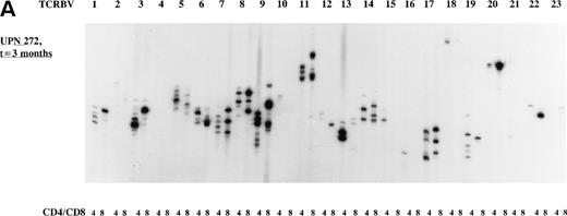 Fig. 2. Representative examples of deviated and normal TCR CDR3 size distributions. (A) Analysis of CDR3 size distribution patterns in UPN 272 at 3 months after allo-BMT in CD4+ and CD8+ T-cell subsets as an example of a deviated/less heterogenous distribution of TCR CDR3 sizes. (B) Similar analysis in UPN 301 at 3 months after allo-BMT in CD4+ and CD8+ T-cell subsets as an example of a less heterogenous/Gaussian distribution of TCR CDR3 sizes. (C) UPN 301 at 1 year after allo-BMT in CD4+ and CD8+ T-cell subsets as an example of a Gaussian distribution of TCR CDR3 sizes. Lanes indicate from left to right TCRBV families (1 through 23).