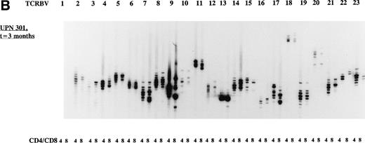 Fig. 2. Representative examples of deviated and normal TCR CDR3 size distributions. (A) Analysis of CDR3 size distribution patterns in UPN 272 at 3 months after allo-BMT in CD4+ and CD8+ T-cell subsets as an example of a deviated/less heterogenous distribution of TCR CDR3 sizes. (B) Similar analysis in UPN 301 at 3 months after allo-BMT in CD4+ and CD8+ T-cell subsets as an example of a less heterogenous/Gaussian distribution of TCR CDR3 sizes. (C) UPN 301 at 1 year after allo-BMT in CD4+ and CD8+ T-cell subsets as an example of a Gaussian distribution of TCR CDR3 sizes. Lanes indicate from left to right TCRBV families (1 through 23).
