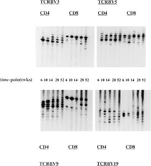 Fig. 3. Presence and persistence of dominant TCR clonotypes after allo-BMT. Longitudinal analysis of TCR CDR3 size distribution patterns in UPN 272 (transplantation group I) at 6, 10, 14, 28, and 52 weeks after the TCD allo-BMT. Shown are spectratypes of TCRBV3, TCRBV5, TCRBV9, and TCRBV19 in the CD4+ as well as in the CD8+ T-cell subsets