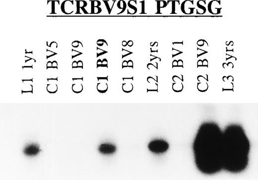 Fig. 6. Longitudinal TCR analysis of T cells responding to TT. Shown is the Southern blot of the TCRBV9 PCR products of TT-specific T-cell lines and clones obtained from UPN 285 at 3 consecutive years after allo-BMT using the TCR CDR3-specific TCRBV9S1 (PTGSG) oligonucleotide (Table 6) as hybridization probe. L1, TT-T cell line generated at 1 year after allo-BMT; C1, T-cell clone at 1 year post-BMT; L2/C2, line/clone 2 years post-BMT; L3, line 3 years post-BMT with TCRBV family (TCRBV1, TCRBV5, TCRBV8, and TCRBV9). In bold is the TCR CDR3 sequence for which the oligonucleotide probe was designed.