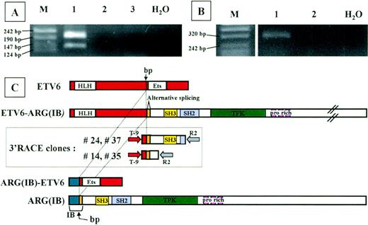 Fig. 2. Analysis of the chimeric proteins. RT-PCR analysis ofETV6-ARG (A) and ARG-ETV6 (B) fusion products. Total RNA from the patient (lane 1) and 2 different healthy donor white blood cells (lanes 2 and 3) was used for RT-PCR with primers located in the relevant exons of ETV6 and ARG(see Materials and Methods). Marker sizes are indicated on the left. (A) RT-PCR analysis of ETV6-ARG. Two specific bands of 194 and 131 bp, respectively, were detected. The different PCR products are the result of an alternative splicing event in the ARGgene, as shown in (C). (B) RT-PCR analysis of ARG-ETV6. One specific band of 343 bp was detected. (C) Schematic representation of ETV6 (top) and ARG(IB) (bottom) cDNAs, 3′RACE clones (boxed), and predicted ETV6-ARG andARG-ETV6 fusion proteins. The vertical arrow indicates the breakpoint. The alternatively spliced hypothetical ARG exon is indicated. HLH, helix-loop-helix domain; ETS, ETS-family DNA binding domain; SH3, SH3 domain; PTK, protein-tyrosine kinase domain; pro rich, proline-rich domains. Full-length cDNAs from the ARG andETV6 genes are shown at the top and bottom, respectively. The 2 different types of 3′RACE-PCR clones are shown in the box. The nested PCR primers are indicated as arrows at the extremities of the RACE clones.