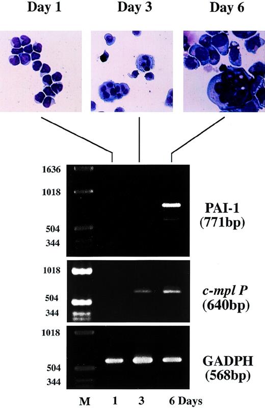 Fig. 5. Expression of PAI-1 and c-Mpl mRNA during short-term culture of normal human cord blood CD34+ progenitor cells with TPO. The CD34+ cells were isolated from human cord blood using antihuman CD34 MoAb bound to magnetic microspheres and cultured in the presence of 10 ng/mL TPO. The cells were harvested at the indicated time points and subjected to morphologic examination on Wright-Giemsa staining cytospin slides (upper panel) and RT-PCR analysis for PAI-1, c-mpl P and GAPDH mRNA expression (lower panel). Amplified products were analyzed on 2% agarose gels followed by ethidium bromide staining. M, molecular size marker.