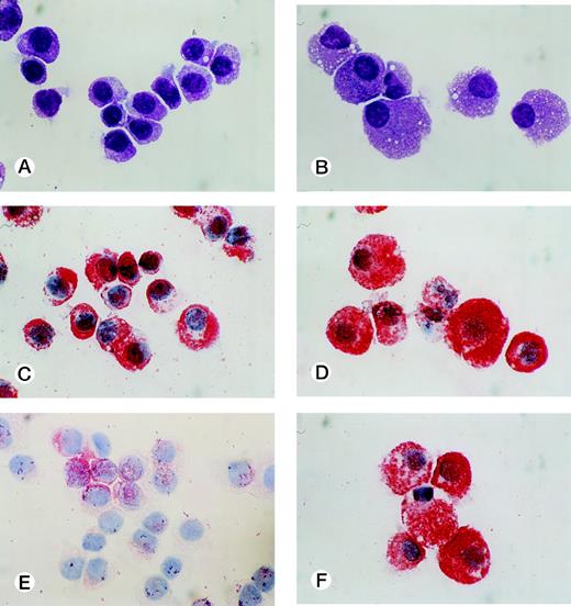 Fig. 3. Cytological characteristics of 10-week and 40-week cultured cells grown by SCF. Cytochemical and immunologic stainings of the cultured cells grown by 10 ng/mL of SCF were performed on cytocentrifuged samples. Staining of 10-week cultured cells (A) and 40-week cultured cells (B) with May-Grünwald-Giemsa. Staining of 10-week cultured cells (C) and 40-week cultured cells (D) with an MoAb for tryptase. Staining of 10-week cultured cells (E) and 40-week cultured cells (F) with an MoAb for chymase. (Original magnification × 1,000.)