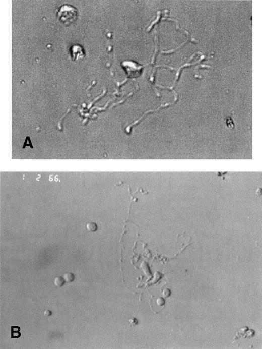 Fig. 1. Platelet-producing normal and WAS MKs have the same morphological aspect. CD34+ cells of WAS patients (A) or normal controls (B) were purified from blood or bone marrow and were grown in the presence of PEG-rHuMGDF and SCF. Analysis of cultured cells under light microscopy by day 8 allowed the identification of platelet-producing MK characterized by the extension of very long and thin pseudopods. They give rise to proplatelets by breaking irregularly at several constriction sites. The frequency and appearance of these platelet shedding MKs were similar in WAS patients (A) and in normal controls (B).