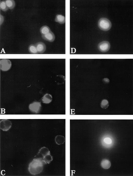 Fig. 2. Abnormal F-actin redistribution in WAS MKs. Cultures were performed as described in Fig 1. At day 8, cells were fixed and, after cytocentrifugation, were incubated with anti-vWF (TRITC) to localize the MKs (B and E) and with phalloidin (FITC) to study F-actin distribution (C and F). DNA was stained by Hoechst dye (A and D). In normal MKs (A, B, and C), F-actin distribution was located linearly under the cytoplasmic membrane and regularly distributed (C), while in WAS MKs (D, E, and F), F-actin was localized in the center of the cell (F).