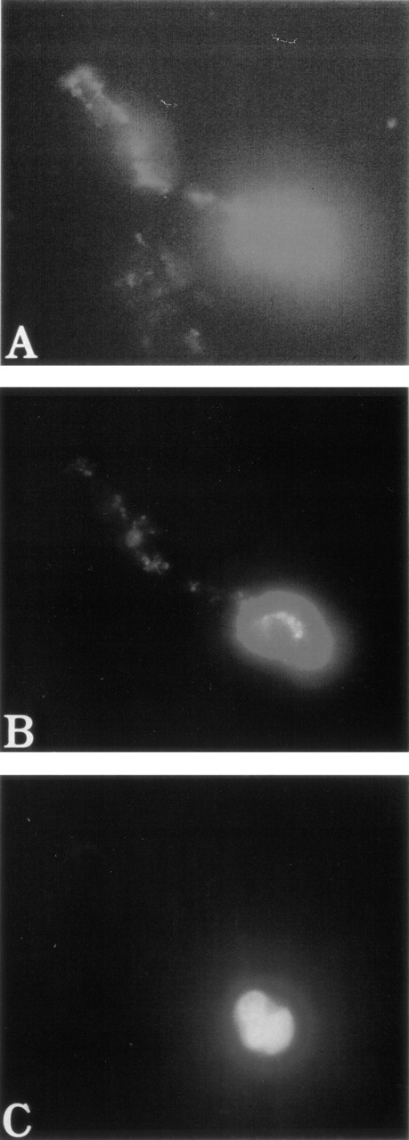 Fig. 3. Immunofluorescent appearance of a platelet-producing WAS MK. Cultures were performed and labeled as described in Fig 2. Phalloidin staining (FITC) was distributed linearly all along the pseudopod that gives rise to platelets by breaking irregularly at several constriction sites (A). vWF (TRITC) was present in this pseudopod (B), while Hoechst staining determined the localization of the nucleus (C). This immunofluorescent appearance of platelet-producing WAS MK was similar to that observed in normal control platelet-producing MKs (not shown).